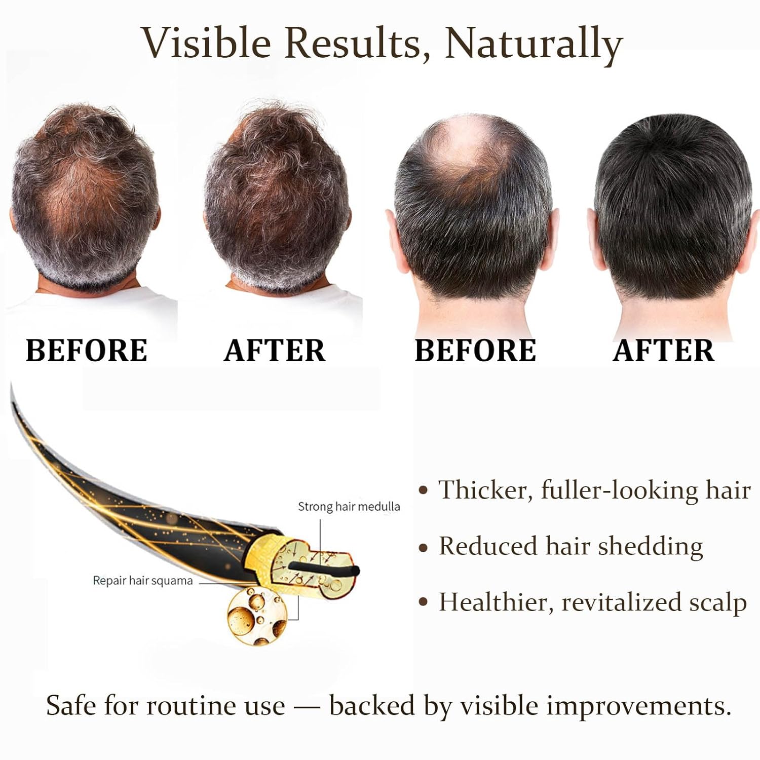 0.25mm Hair Care Micro-needle  - đánh giá và giá Derma Roller 0.25