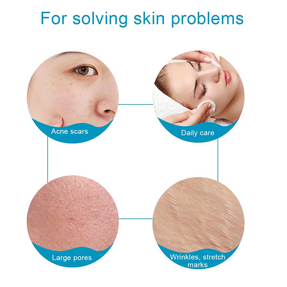 540 Needles Derma Roller Titan - đánh giá và giá Derma Roller 0.25